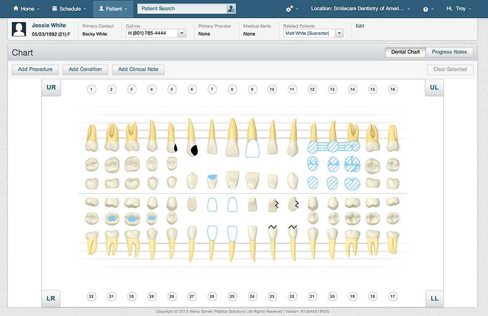 Dentrix Charting