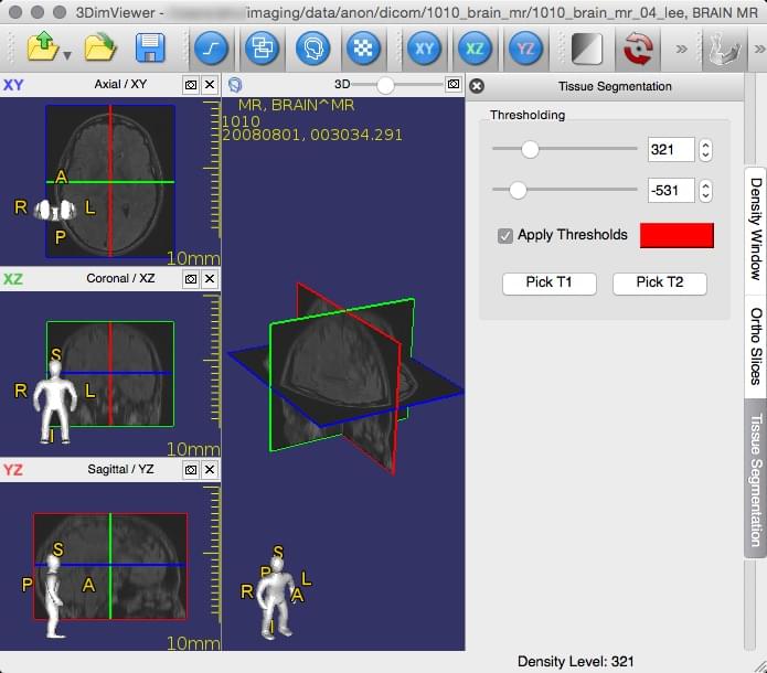 Osirix dicom viewer for mac free download