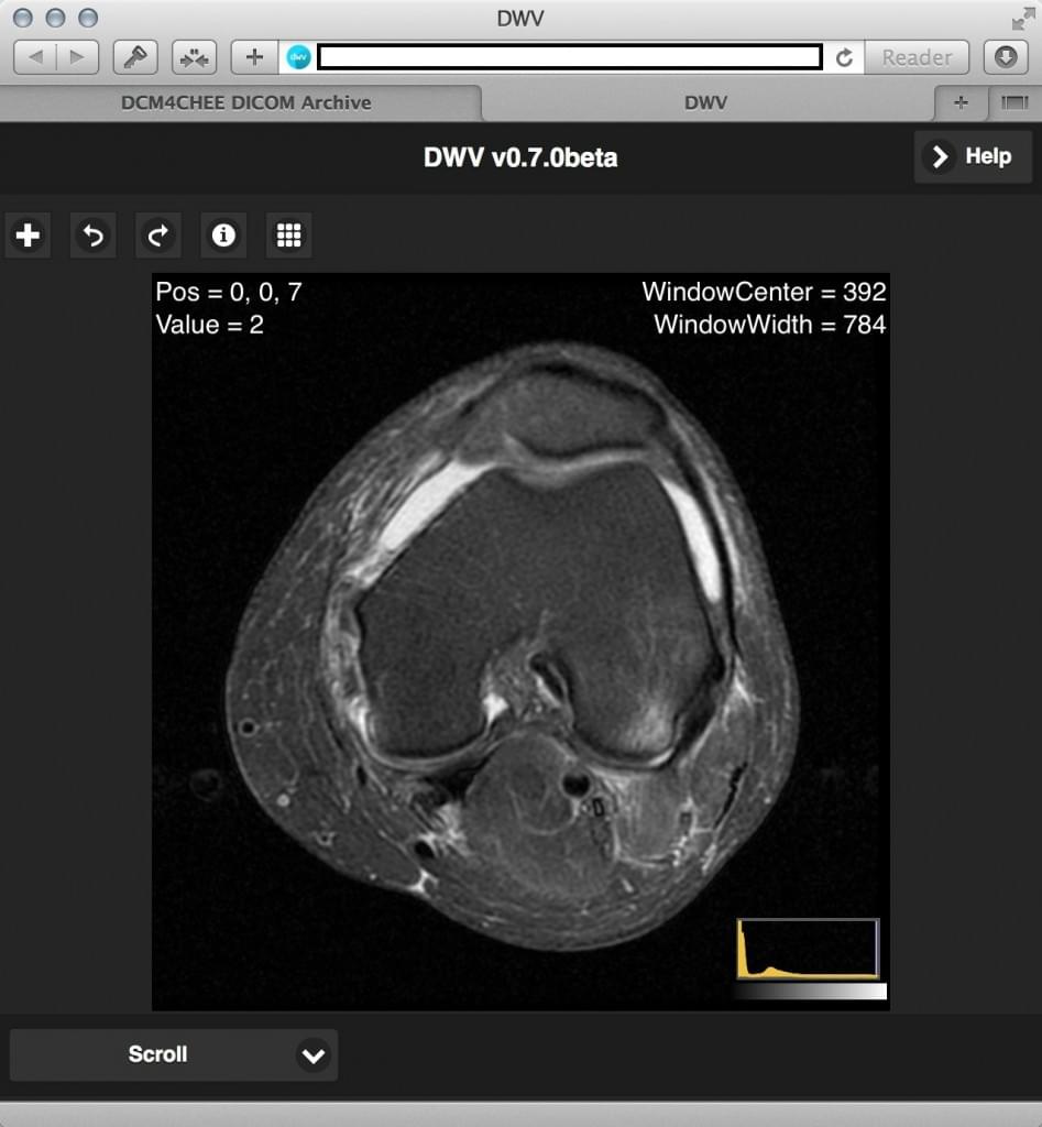 what is the best free dicom viewer for a general person