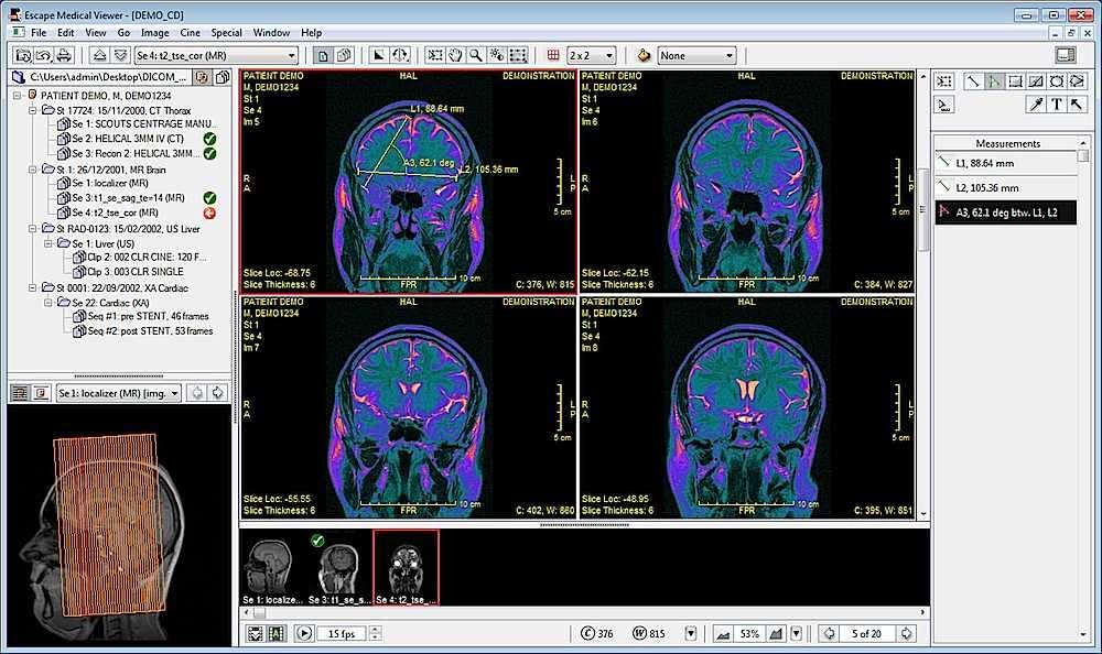 free dicom image viewer for mac