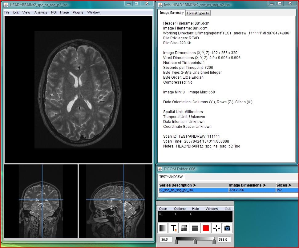 free dicom viewer with send utility