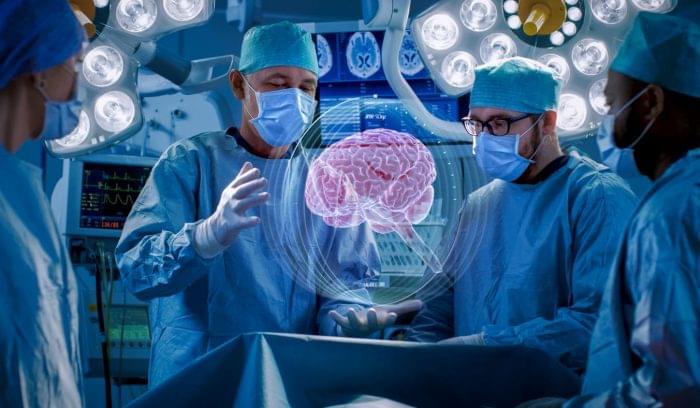 Doctors gathered around a projected image of a brain, showing the use of AI in healthcare.